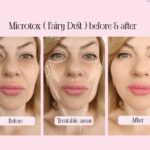 Unlocking The Mystery: What Is Microtox Explained