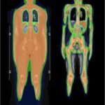 Medical imaging scan of a human body displaying different internal structures in color.