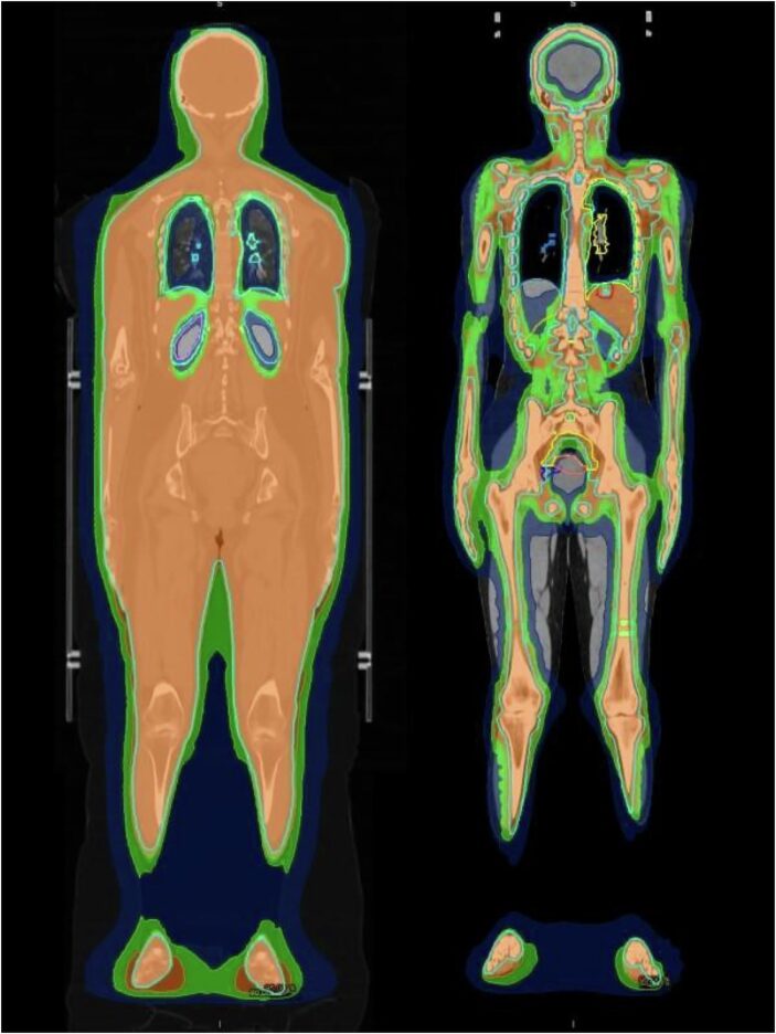 Medical imaging scan of a human body displaying different internal structures in color.